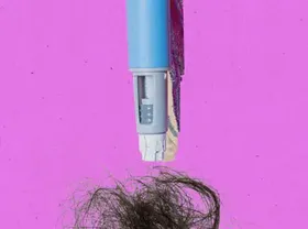 Does GLP-1 Use Result in Significant Hair Loss?