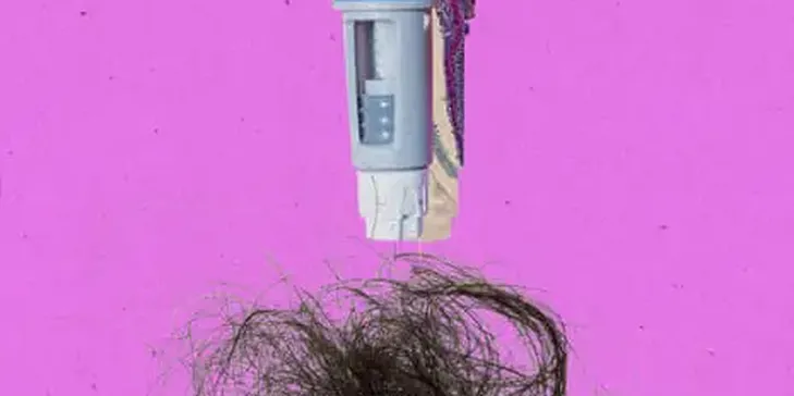 Does GLP-1 Use Result in Significant Hair Loss?